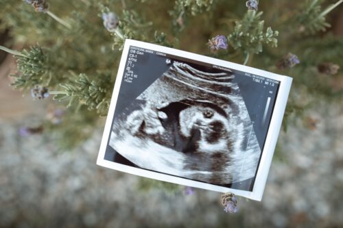 Photo of a sonograph with greenery in the background. 