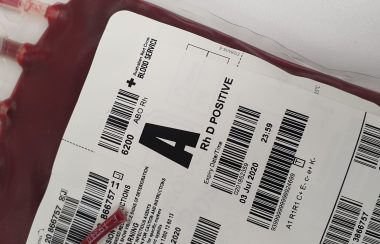 Photo of a blood bag, Blood A positive type.